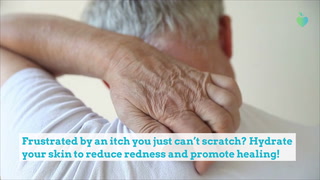 8 Ways to Relieve Your Psoriasis Itch