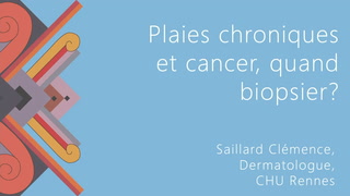 Plaies chroniques et cancer : quand biopsier ?
