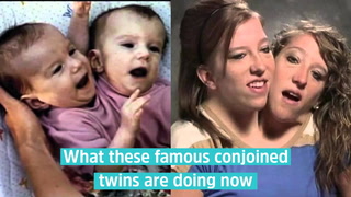 Conjoined Twins Abby and Brittany Hensel Live an Extremely Low-Profile Life  Today After Their Reality TV Days