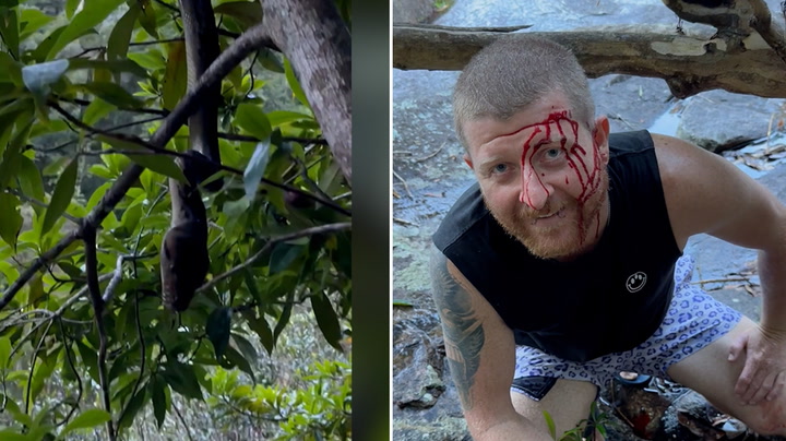 Python leaves hiker bloodied after 'slapping' him