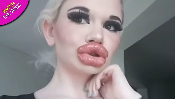 Models With Big Lips