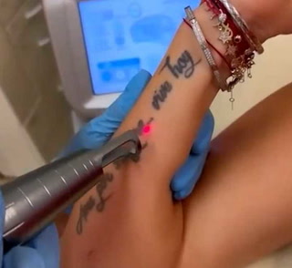 Jesica Cirio se borró el tatuaje que compartían con Martín Insaurralde