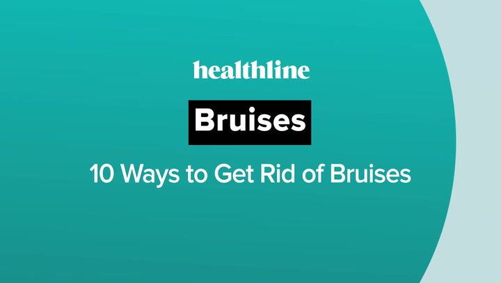 How to Get Rid of Bruises: 10 Remedies