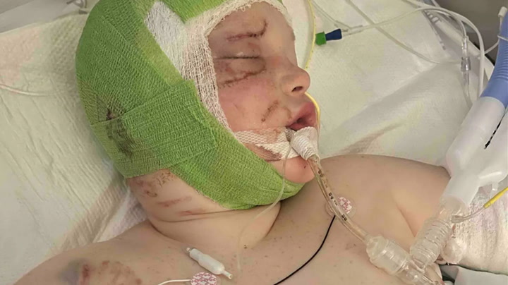 Boy, 11, mauled by pit bulls shares heartbreaking update from hospital
