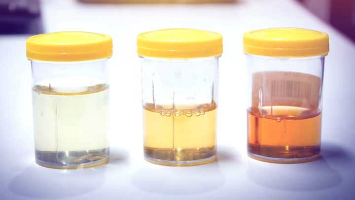 Here's Exactly What The Color Of Your Pee Says About Your Health