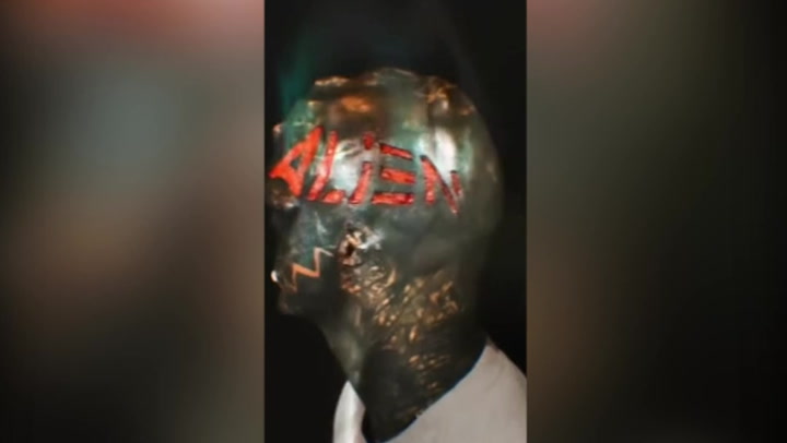 'Black Alien' gets name carved out of flesh on his head