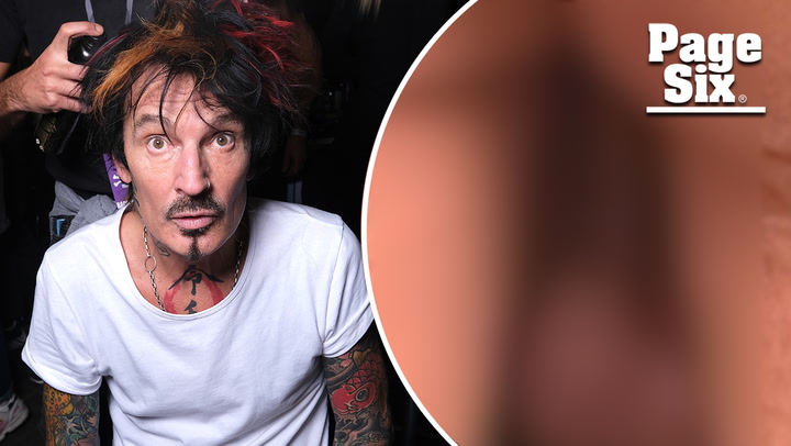 Tommy Lee is nude again in NSFW pic posted on Twitter