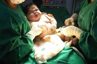 Nació un bebe gigante en Brasil