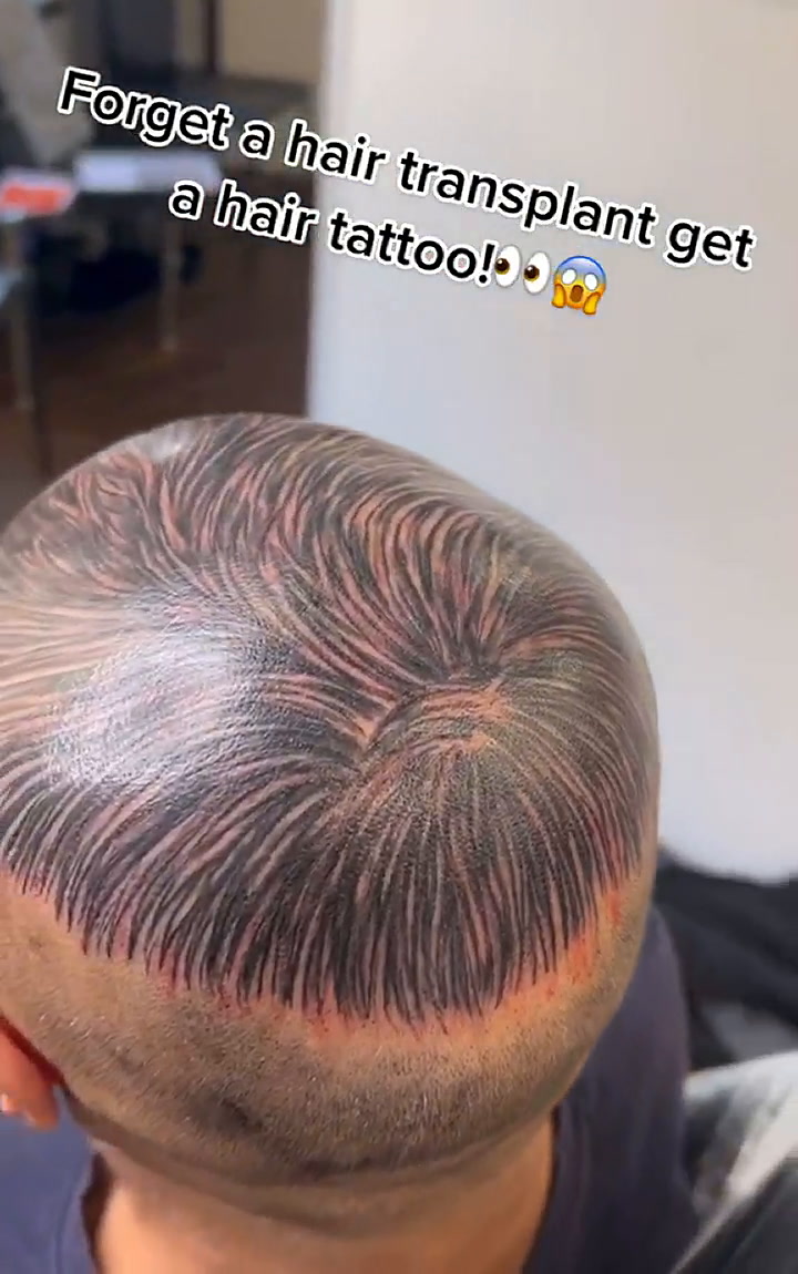 Un hombre se tatuó la cabeza para 'tapar' su calvicie