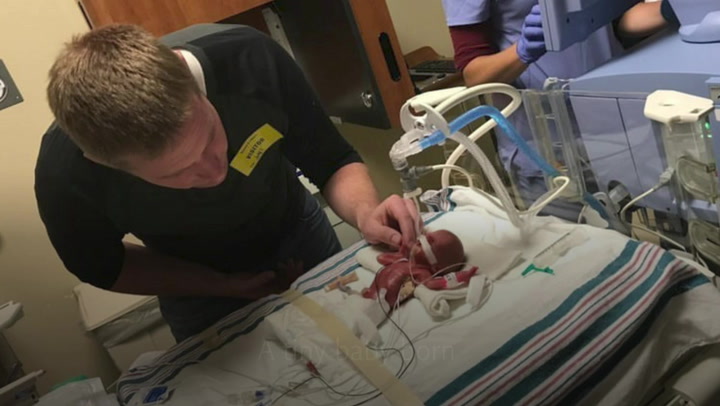 Baby born at 23 weeks survives despite being given 10% chance