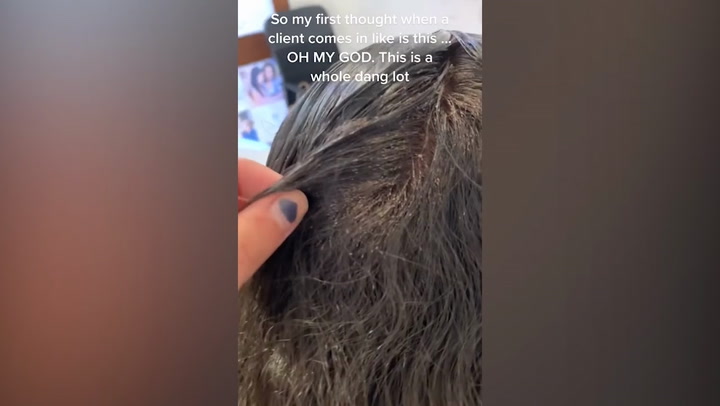 Hairdresser shares video of infestation leaving teen with 'more head lice  than hair' - Mirror Online