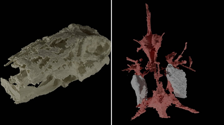 Oldest example of well-preserved vertebrate brain found in ancient fossilised fish