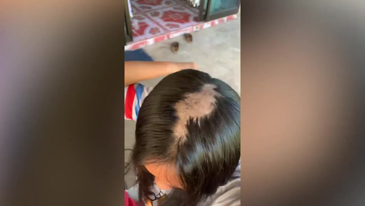 Thai woman loses clumps of hair from DIY hair straightening cream bought on TikTok