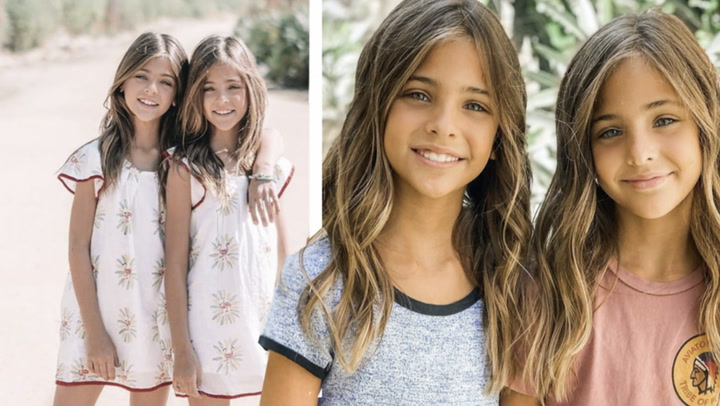10-åringarna kallas världens vackraste tvillingar