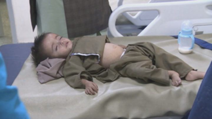Afghan children face threat of acute malnutrition, UNICEF warns
