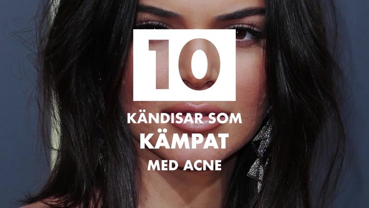 10 kändisar som kämpat med acne