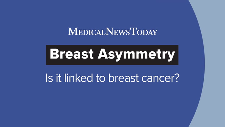 Breast Asymmetry: 9 Reasons You Have Uneven Breasts - HealthyWomen