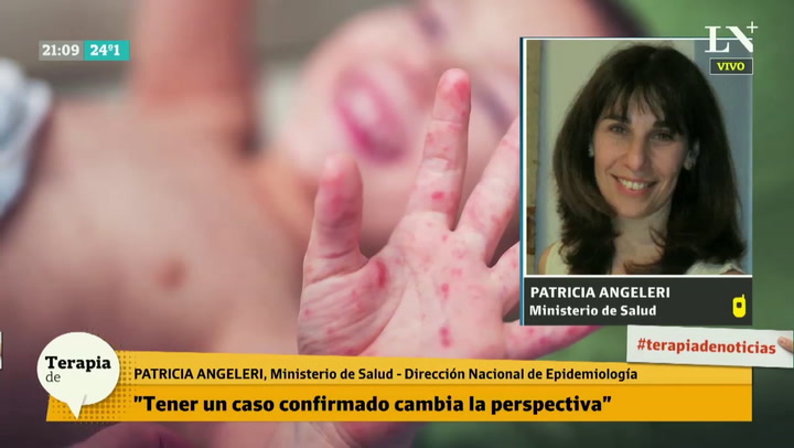 Patricia Angeleri: 'Tener un caso confirmado de sarampion cambia la perspectiva'