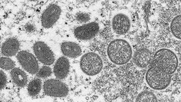  OMS y Unión Europea trabajan contra ‘viruela del mono’ para evitar  pandemia