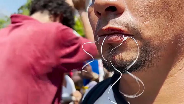 México: migrantes se cosen la boca en protesta
