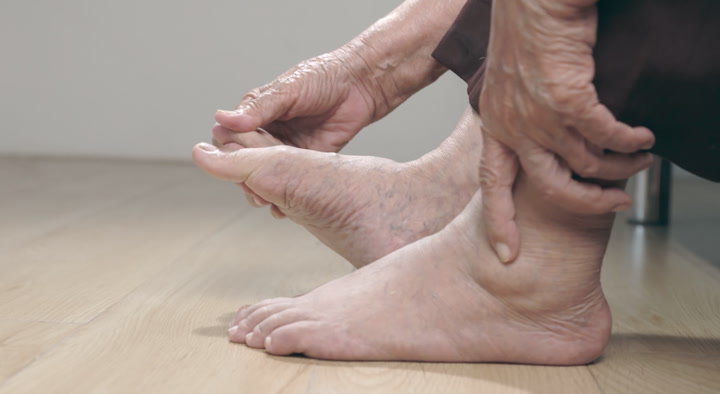 Swollen Feet: Common Causes and Symptoms
