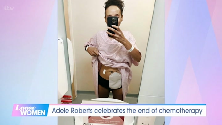 Adele Roberts proudly poses with stoma bag and shares love for her body