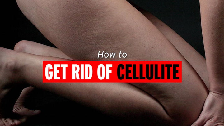 4 Ways to Get Rid of Cellulite - wikiHow