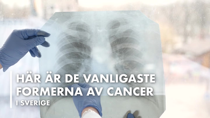 VIDEO: Här är de vanligaste formerna av cancer i Sverige
