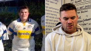Rugby league player blinded by glass attack calls for urgent change