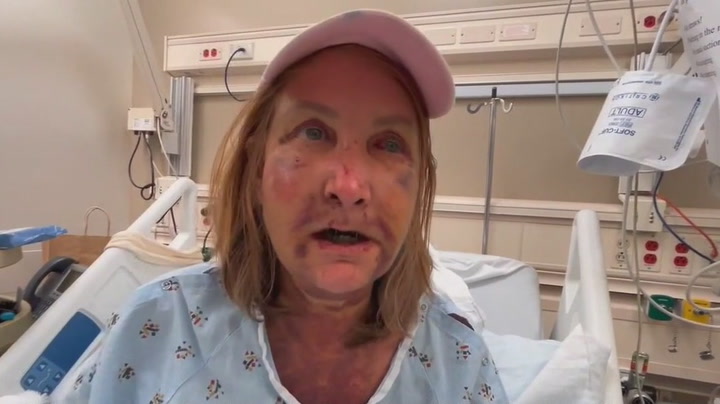 Woman's mouth wired shut after Venice attack