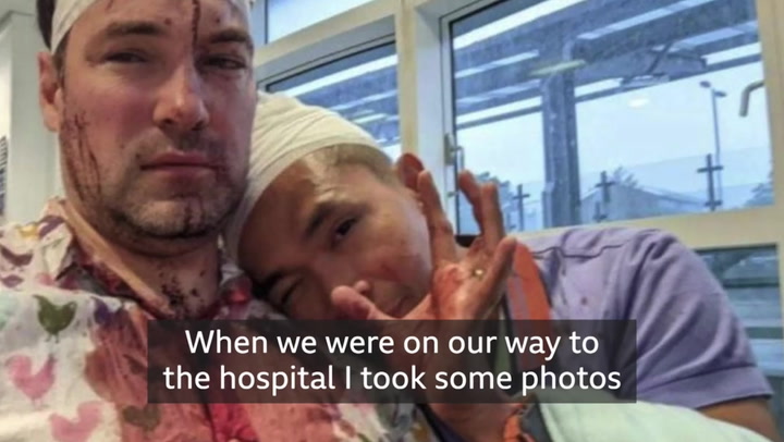 Couple attacked in Birmingham Gay Village speak out