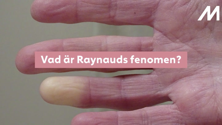 Vad är Raynauds fenomen?
