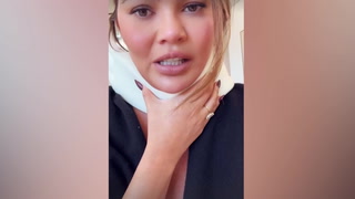Chrissy Teigen reveals neck brace after headstand injury