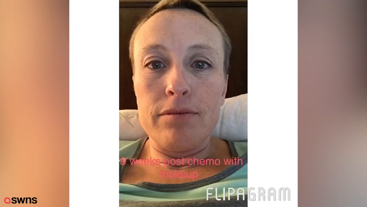My Chemotherapy Diary: 52 Photos of Hair Loss and Recovery