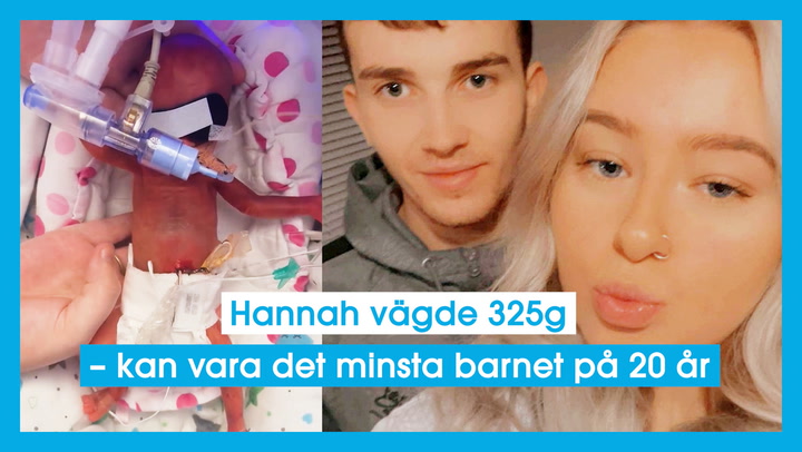 Hannah vägde 325g – kan vara det minsta barnet på 20 år