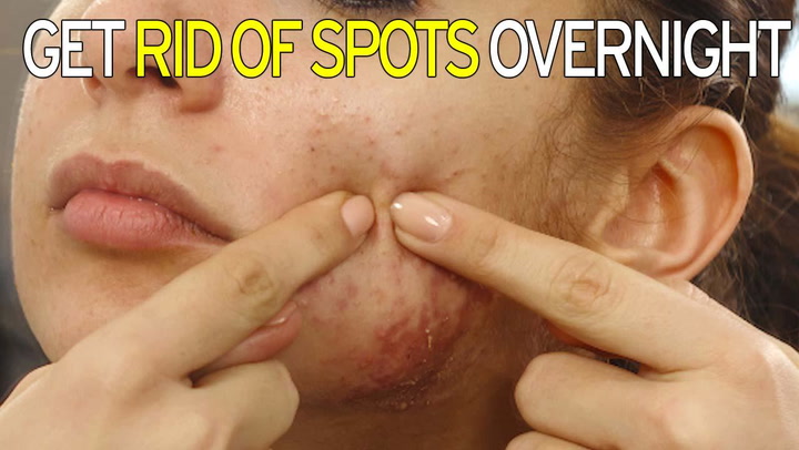 To get rid of spots