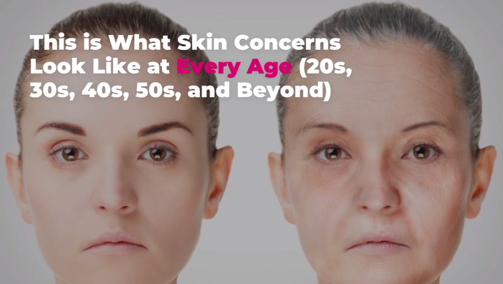 Your Skin Changes As You Age