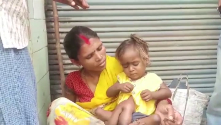 2 yaşındaki 'Örümcek kız'ın belinden dışarı iki fazladan kol ve bacağı çıktı - Dünya Haberleri
