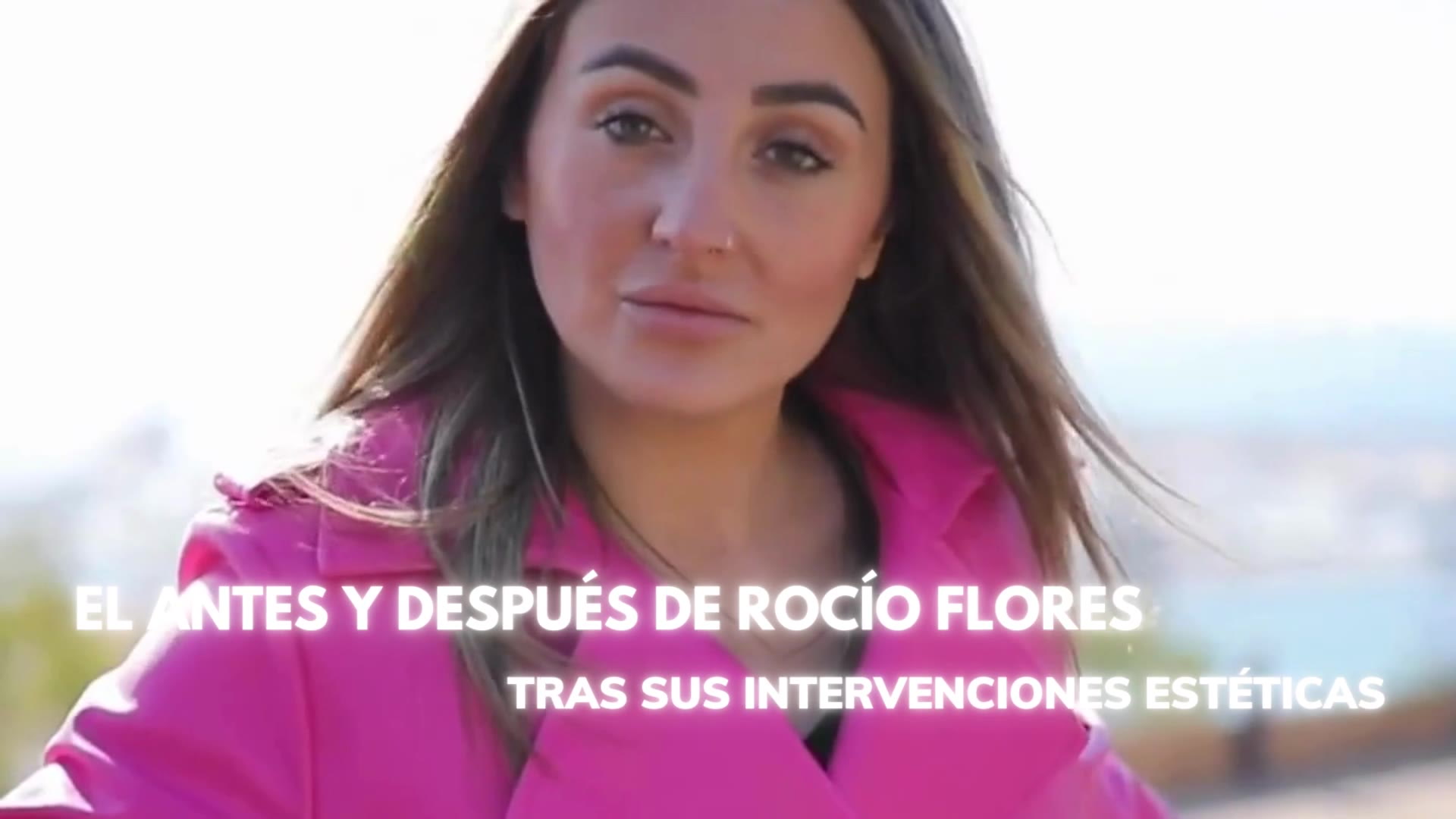 El antes y después de Rocío Flores tras sus intervenciones estéticas thumbnail
