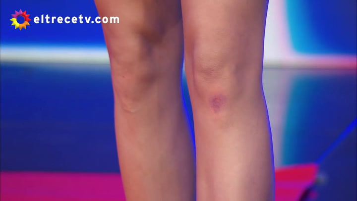 La caída dejó a Laurita Fernández con una lastimadura en la rodilla y la alfombra rota