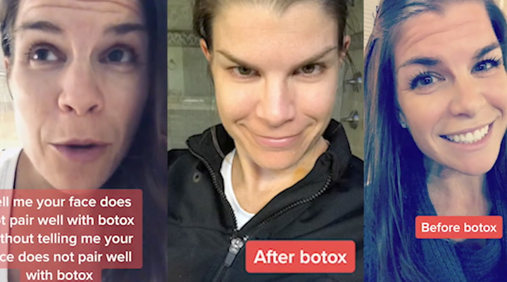 Mum compared to Jack Nicholson after 'too much Botox' left her unrecognisable