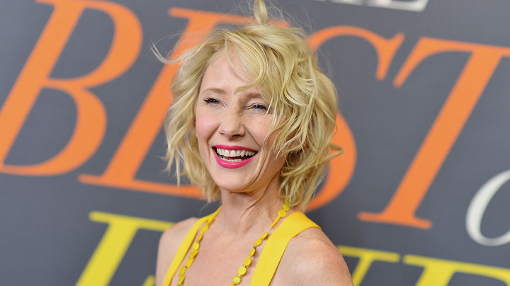 Anne Heche suffers severe burns after crashing car into LA home
