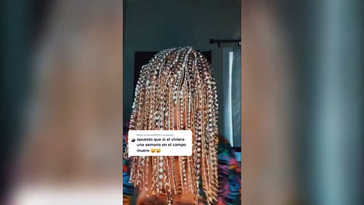 Rapper Dan Sur has gold chains surgically attached to his head instead of hair