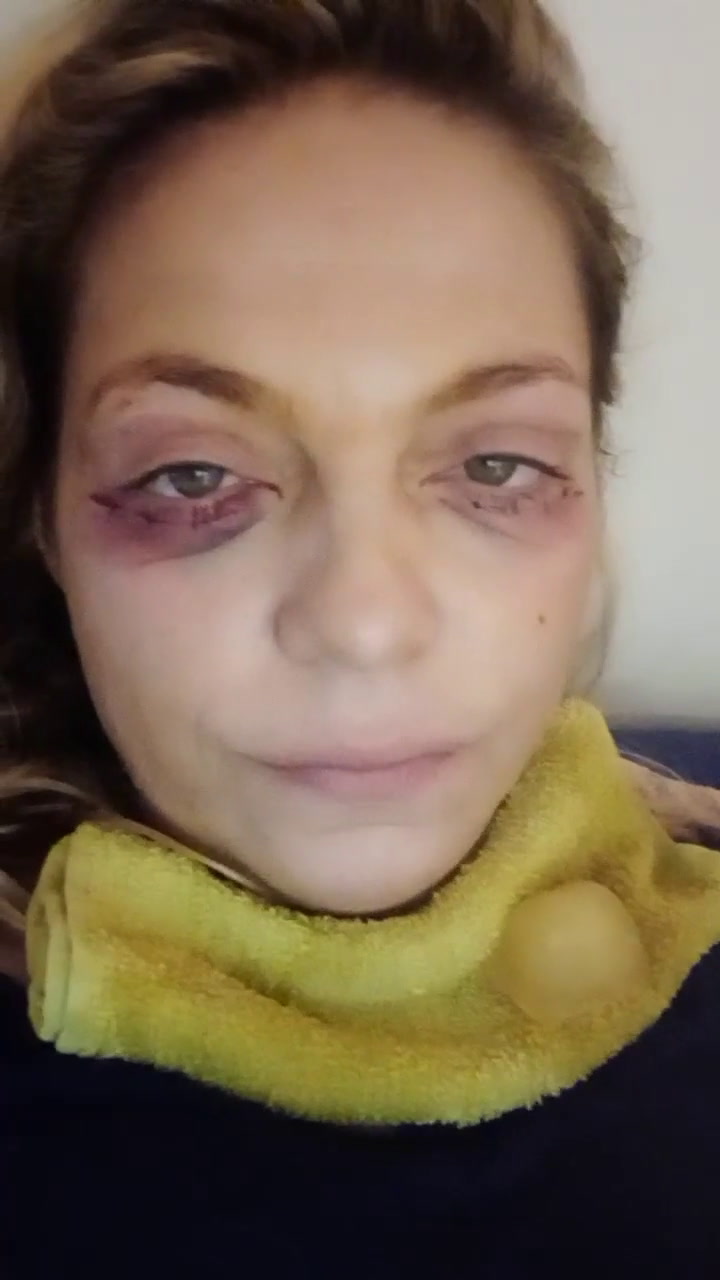 Tamara Paganini explicó en un video por qué está desfigurada