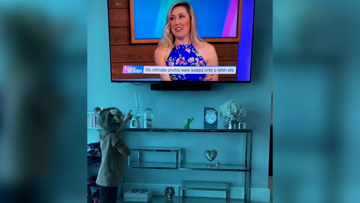 Little girl excited to see woman with arm like hers on TV