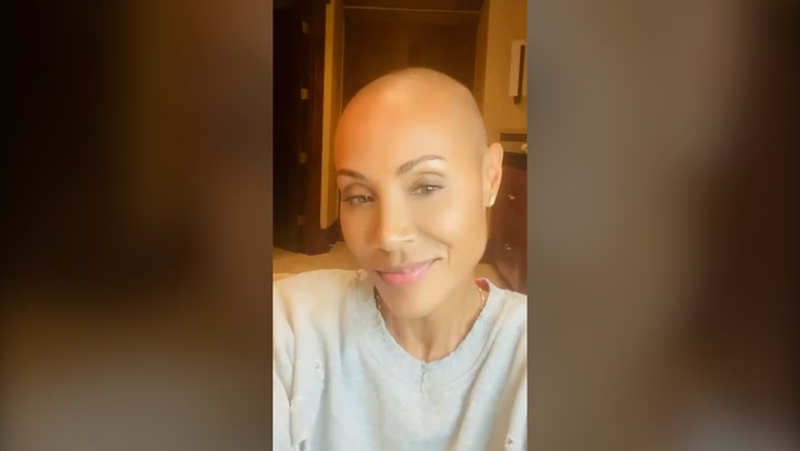 Jada Pinkett Smith speaks out about having alopecia