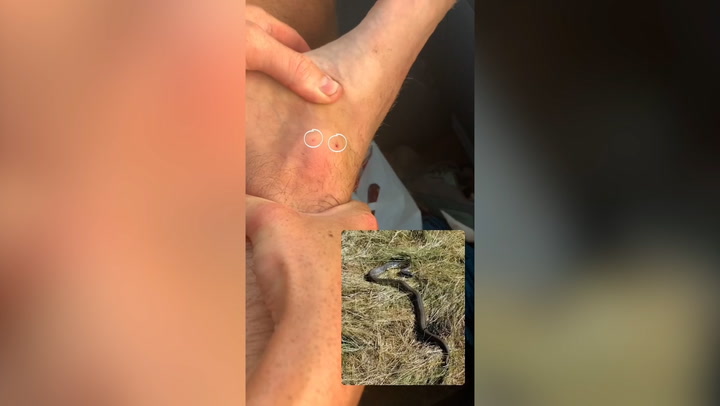 British couple's camping trip turns into nightmare after venomous snake bite