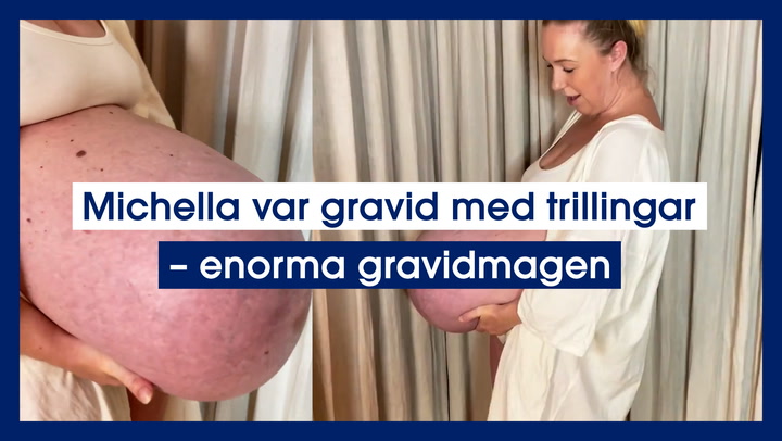 Michella var gravid med trillingar – enorma gravidmagen