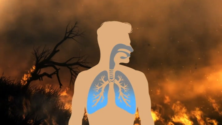 DOES BREATHING IN WILDFIRE SMOKE MEAN LUNG ISSUES FOR LIFE?