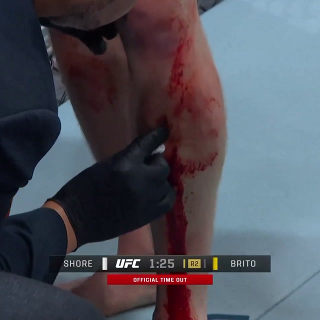 Escalofriante corte en la UFC